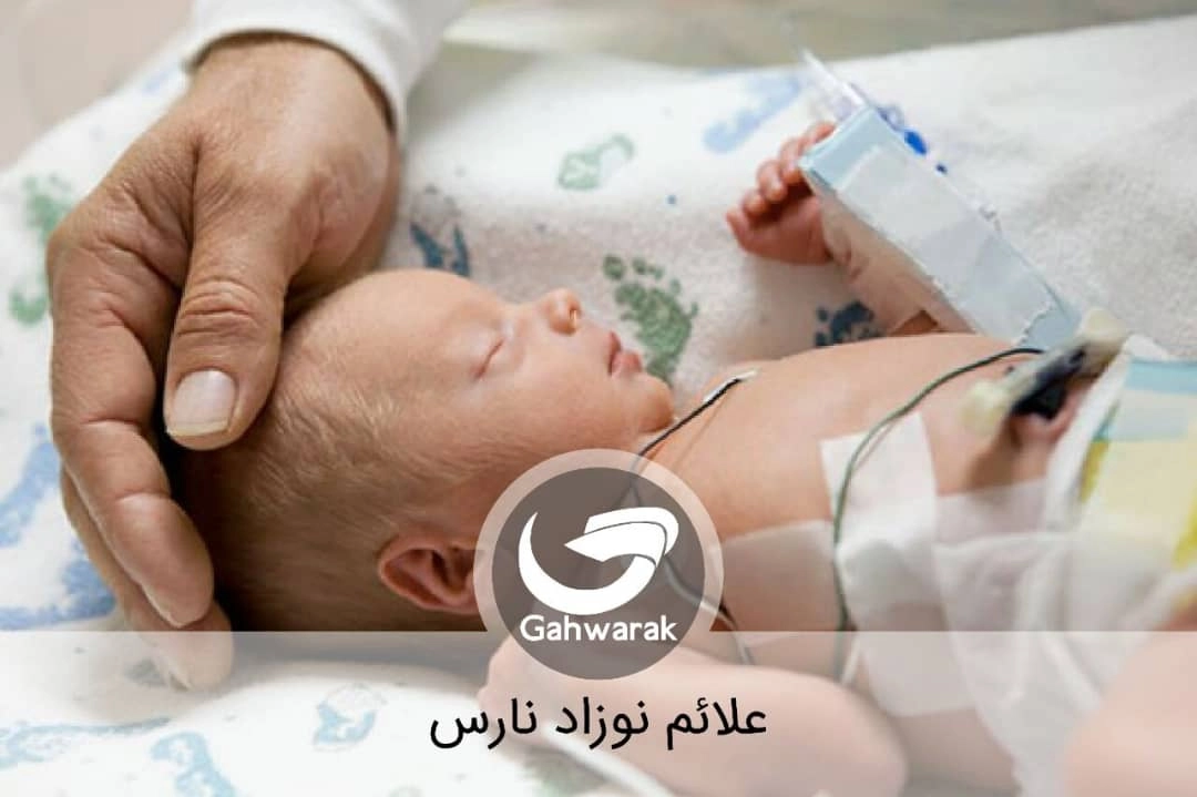 علائم نوزاد نارس چیست؟