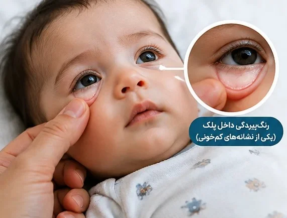 کم‌خونی در نوزادان و کودکان؛ علت‌ها، علائم، تشخیص و درمان در گهوارک