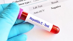 هپاتیت C در کودکان