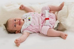 در رفتگی لگن (فمور ) در کودکان