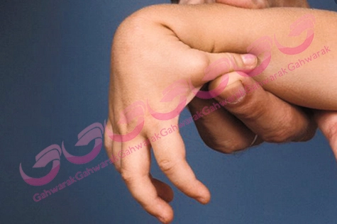 نرمی مفاصل در کودکان