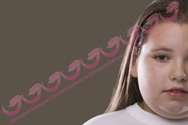 مشکل اضافه وزن کودک