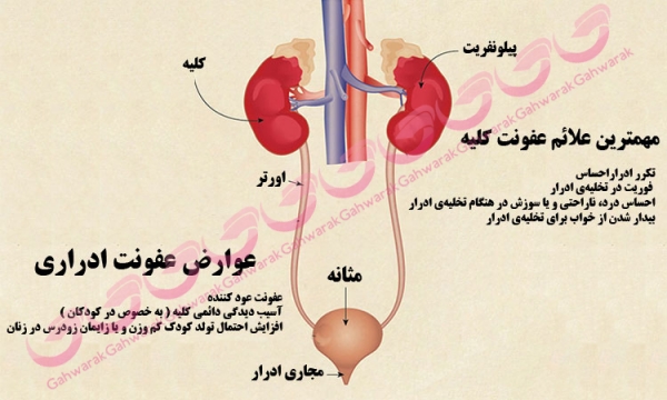 عفونت ادراری درکودکان,دکتر احمد شاه فرهت,گهوارک