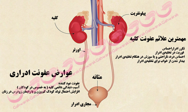 عفونت مجراي ادراري (علائم + علت + پیشگیری و درمان )