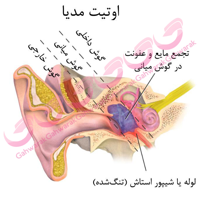 اتیت 