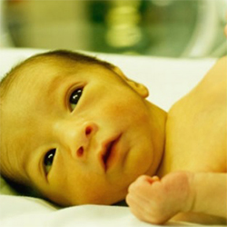 علائم زردی در نوزاد | گهوارک