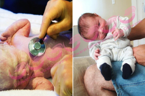 شلی عضلات در نوزادان؛ نشانه‌ها، دلایل و راه‌های درمان